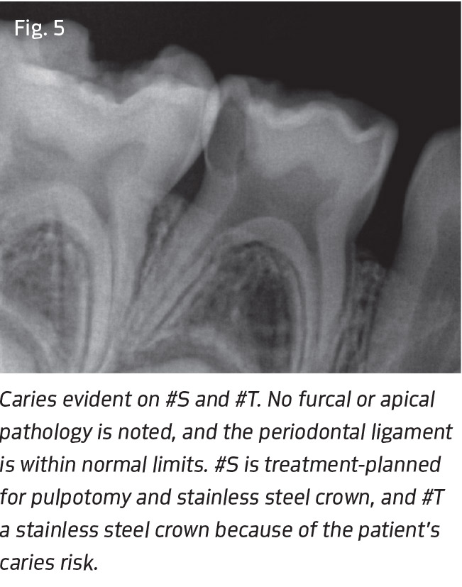 Fig. 5