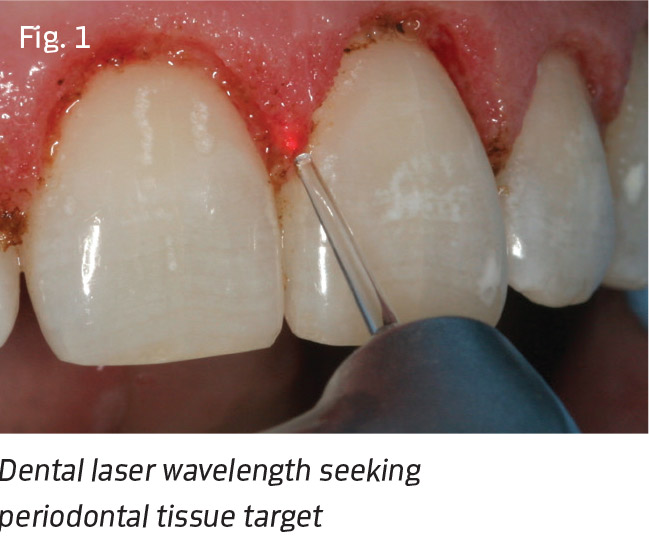 Fig. 1