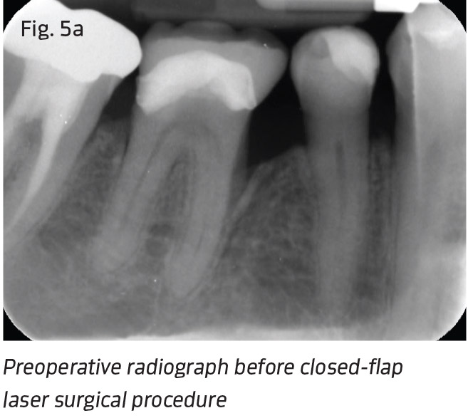 Fig. 5a