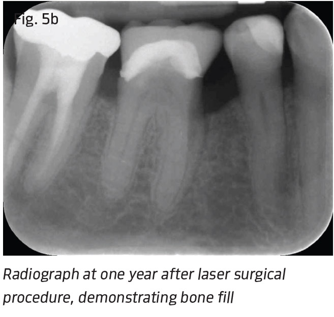 Fig. 5b