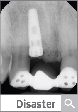 Case Presentation: Disaster of the Day