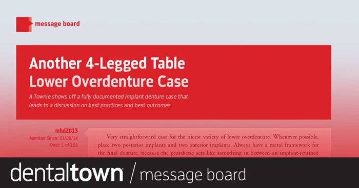 Another 4-Legged Table Lower Overdenture Case