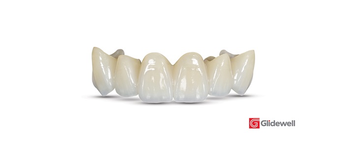 Product Profile: Glidewell