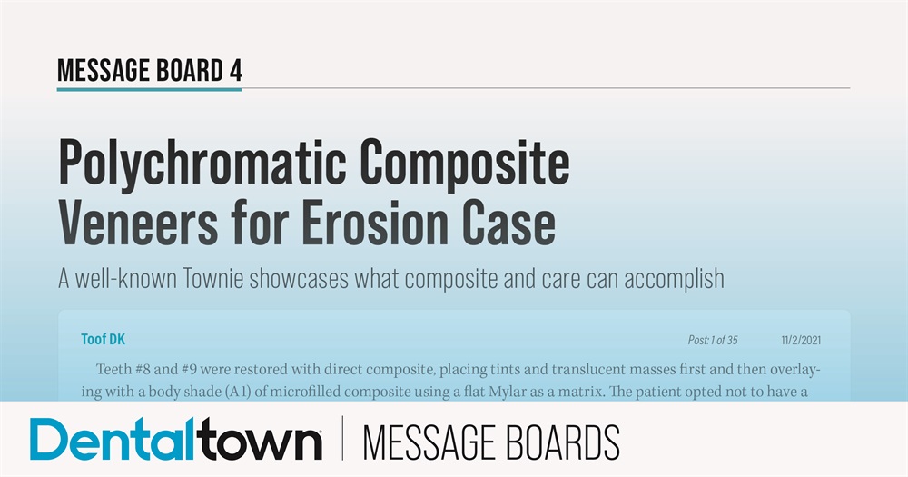 Polychromatic Composite Veneers for Erosion Case