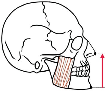 CE: Simplified Accurate Denture Records