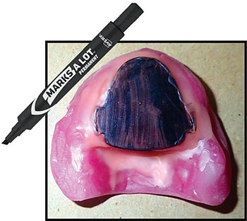 CE: Simplified Accurate Denture Records