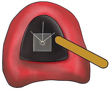 CE: Simplified Accurate Denture Records