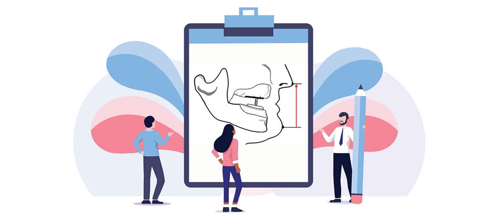 CE: Simplified Accurate Denture Records