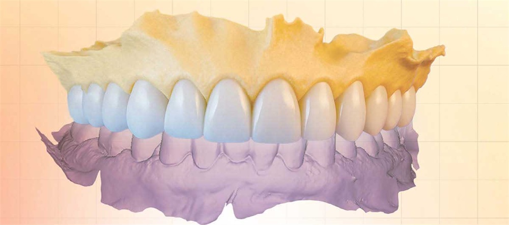 Tech-Driven Full-Mouth Rehab