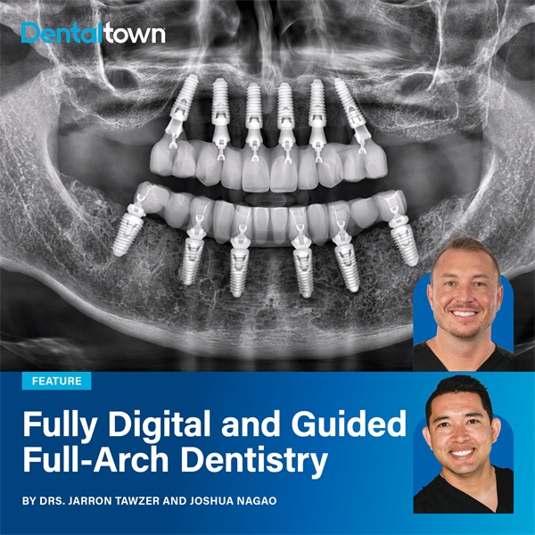 Fully Digital and Guided Full-Arch Dentistry