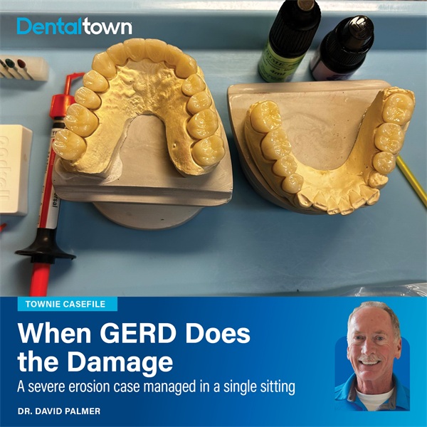 Townie Casefile: When GERD Does the Damage