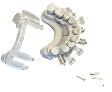 Fully Digital and Guided Full-Arch Dentistry
