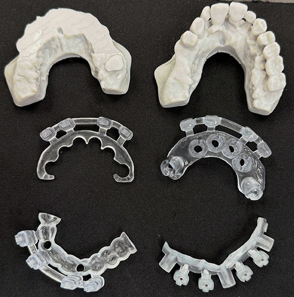 Fully Digital and Guided Full-Arch Dentistry