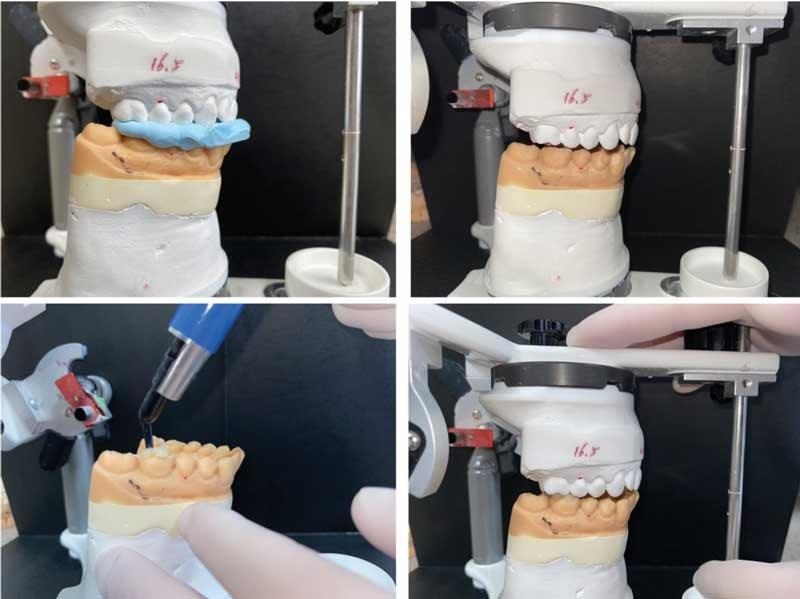Dental Occlusion