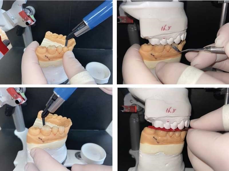 Dental Occlusion