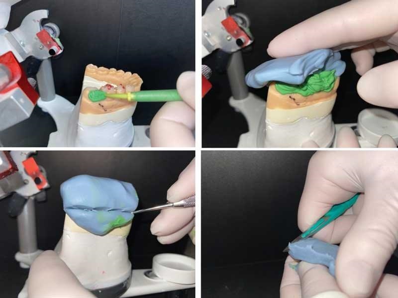 Dental Occlusion