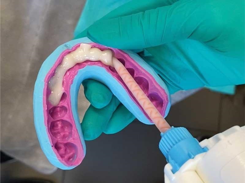 Dental Occlusion