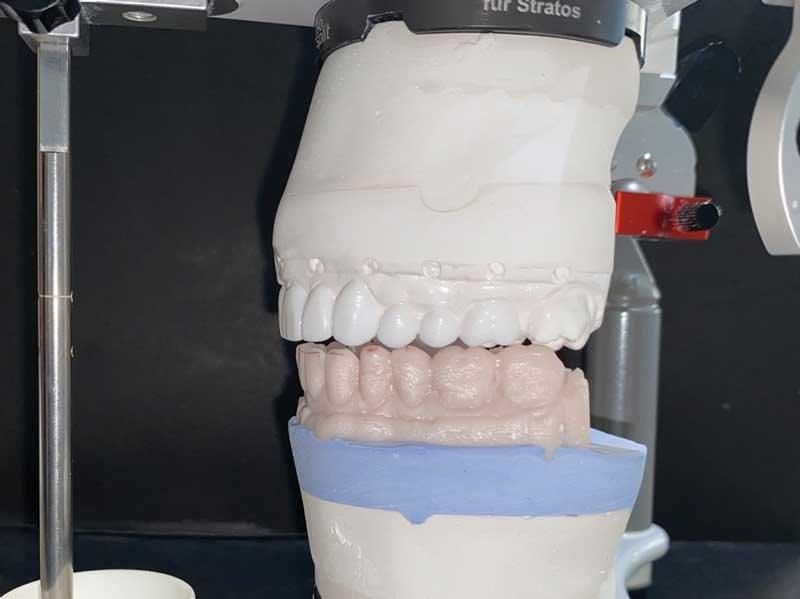 Dental Occlusion