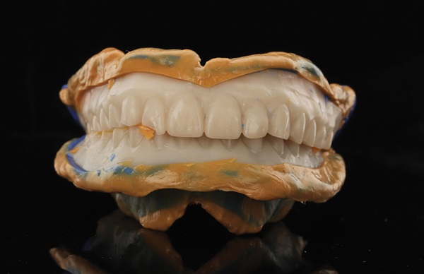 Digital Dentures