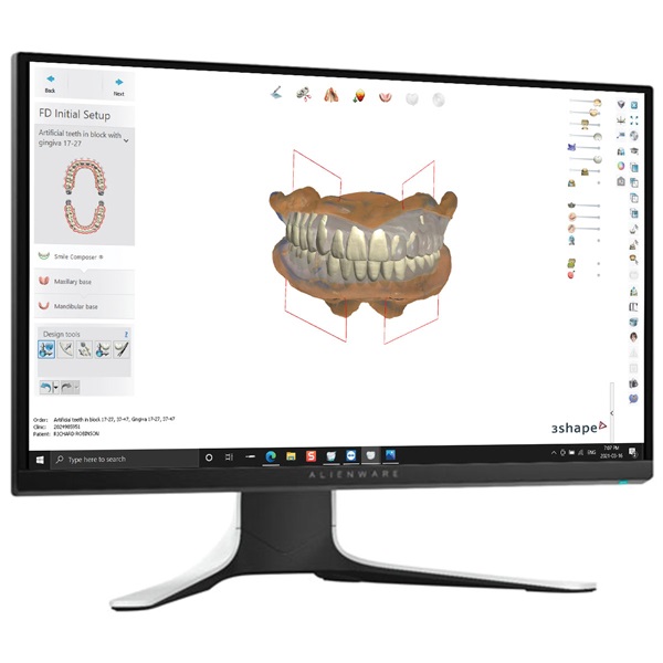 Digital Dentures