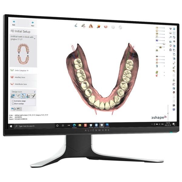 Digital Dentures