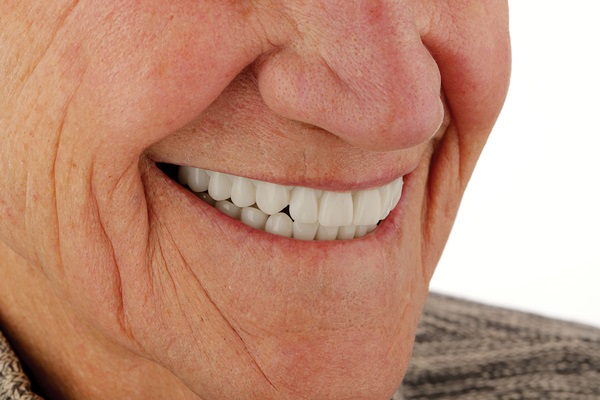 Digital Dentures