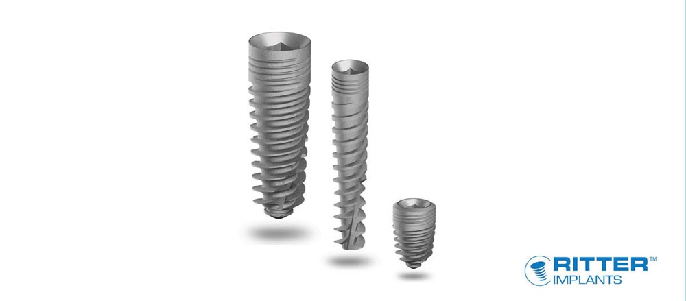 Product Profile: Ritter Implants