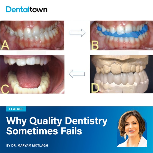 Why Quality Dentistry Sometimes Fails