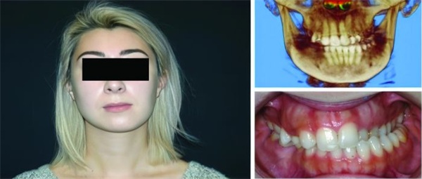 Why Quality Dentistry Sometimes Fails