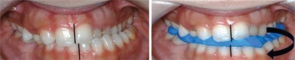 Why Quality Dentistry Sometimes Fails