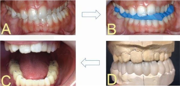 Why Quality Dentistry Sometimes Fails