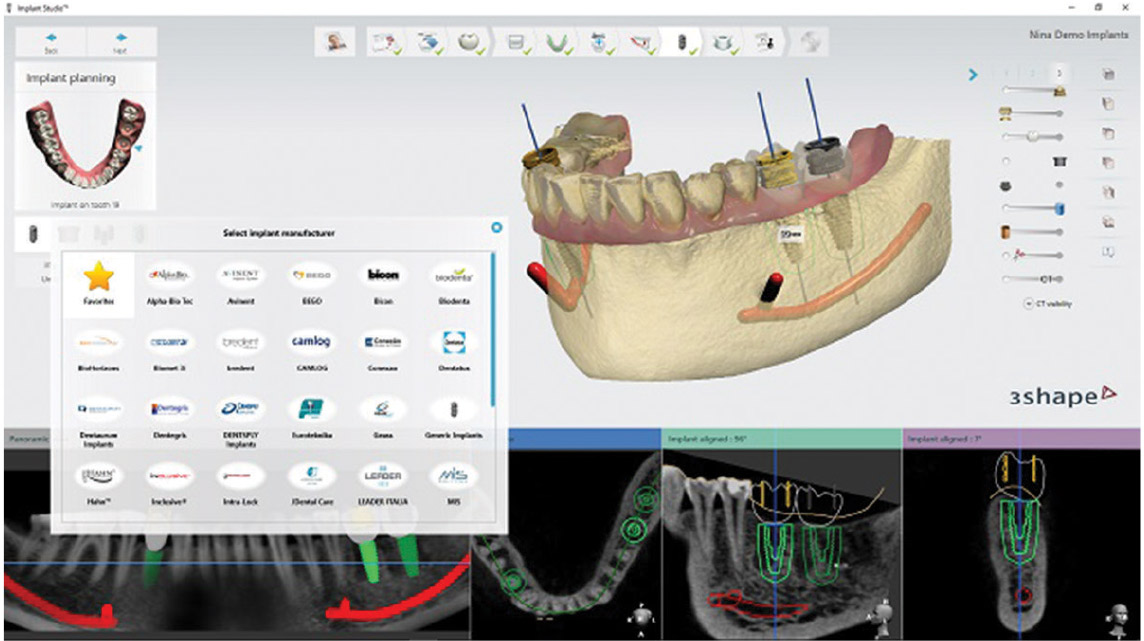 Implant Studio 2016