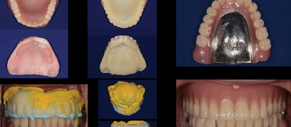 Earned Placement: Medit’s Intraoral Scanners