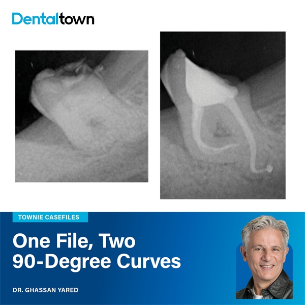 Townie Casefile: One File, Two 90-Degree Curves