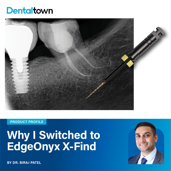Why I Made the Switch: EdgeOnyx X-Find