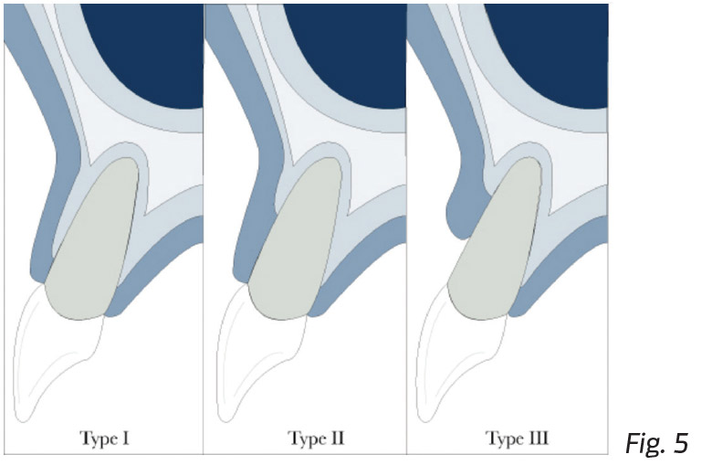 Fig. 5