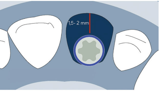 Fig. 2d