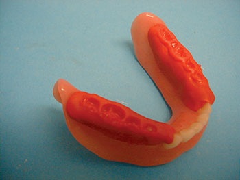 CE: The Essential Try-In Acceptance Appointment