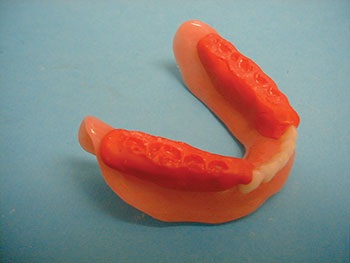 CE: The Essential Try-In Acceptance Appointment