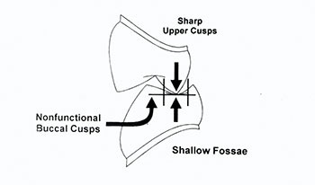 CE: The Essential Try-In Acceptance Appointment