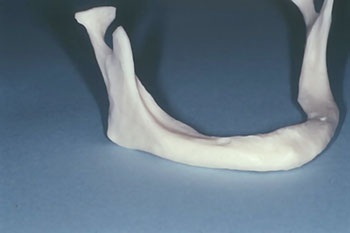 CE: The Essential Try-In Acceptance Appointment