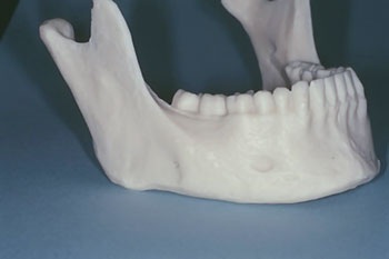 CE: The Essential Try-In Acceptance Appointment