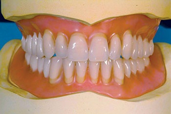 CE: The Essential Try-In Acceptance Appointment