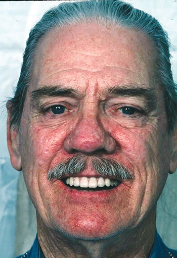 CE: The Essential Try-In Acceptance Appointment