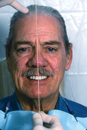 CE: The Essential Try-In Acceptance Appointment