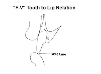 CE: The Essential Try-In Acceptance Appointment