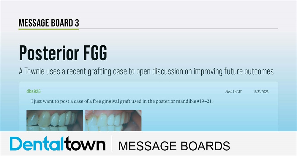 Posterior FGG