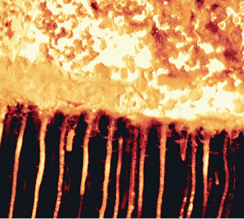 A histological image demonstrates that biodentine is capable of inserting into the dentinal tubules and reinforcing the dentinal structure.