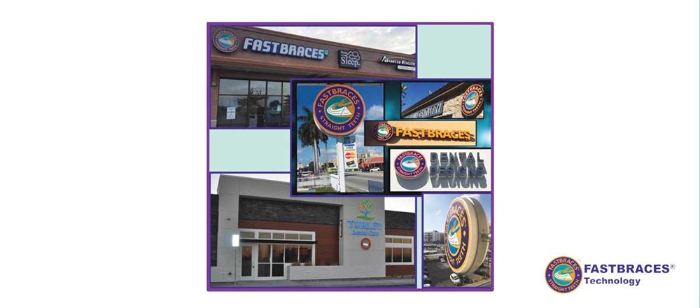 Product Profile: Fastbraces
