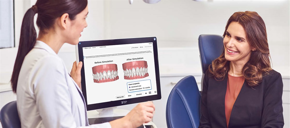 SureSmile Simulator